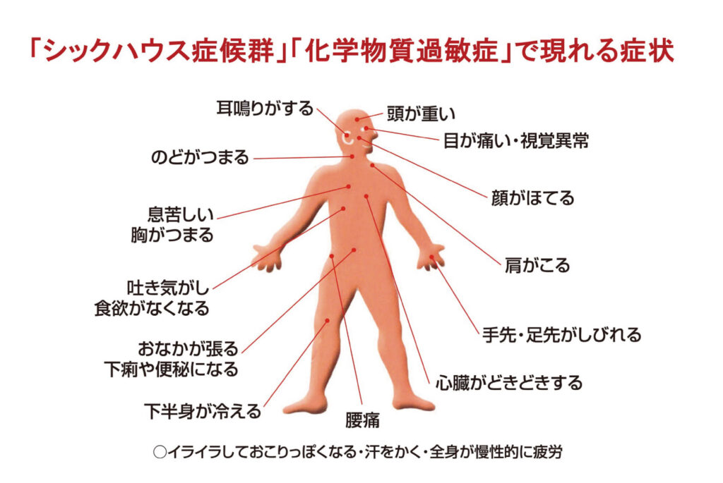 シックハウス症候群や化学物質過敏症で現れる症状の図